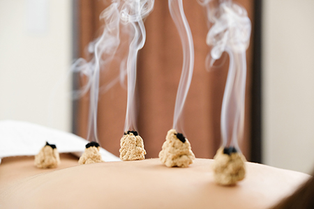 moxibustion 450x300